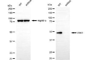Western blotting analysis using VRK1 antibody (ABIN7800811).