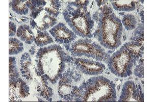 Image no. 2 for anti-RAB30, Member RAS Oncogene Family (RAB30) antibody (ABIN1500557) (RAB30 antibody)