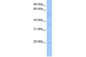 WB Suggested Anti-RG9MTD3 Antibody Titration:  0. (RG9MTD3 antibody  (C-Term))
