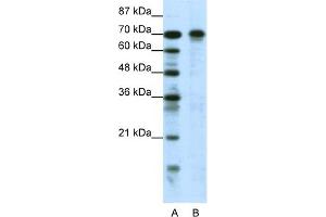 WB Suggested Anti-HIC1 Antibody Titration:  0. (HIC1 antibody  (N-Term))