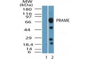 Image no. 1 for anti-Preferentially Expressed Antigen in Melanoma (PRAME) (AA 460-510) antibody (ABIN232167) (PRAME antibody  (AA 460-510))