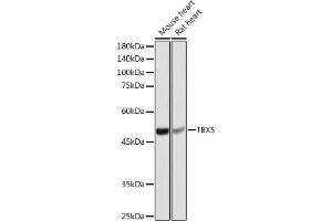 Western blot analysis of extracts of various cell lines, using TBX5 antibody (ABIN7270701) at 1:1000 dilution. (T-Box 5 antibody  (AA 1-70))