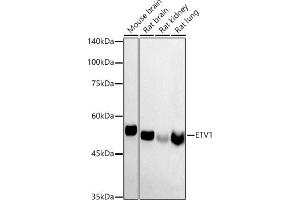 Western blot analysis of extracts of various cell lines, using ETV1 antibody (ABIN6129795, ABIN6140328, ABIN6140330 and ABIN6223003) at 1:1000 dilution.