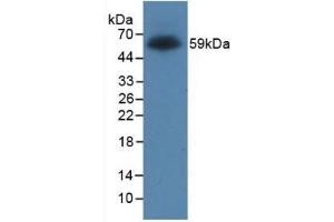 Detection of Recombinant Protein RPK170Hu01 with GST-tag using Anti-Glutathione S Transferase (GST) Tag Monoclonal Antibody (GST antibody  (AA 1-218))