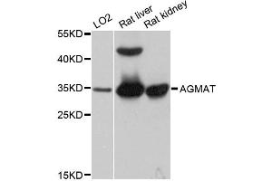 Western blot analysis of extracts of various cell lines, using AGMAT antibody. (AGMAT antibody)