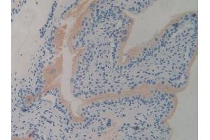 Immunohistochemistry (IHC) image for anti-Cartilage Oligomeric Matrix Protein (COMP) (AA 554-753) antibody (ABIN7433240)