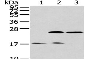 Western Blot analysis of Human fetal brain tissue, Hela and 293T cells using PDPN Polyclonal Antibody at dilution of 1/200 (Podoplanin antibody)