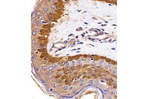 Paraformaldehyde-fixed, paraffin embedded human skin tissue, Antigen retrieval by boiling in sodium citrate buffer (pH6. (S100A2 antibody)