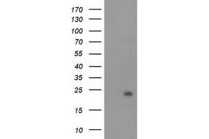 HEK293T cells were transfected with the pCMV6-ENTRY control (Left lane) or pCMV6-ENTRY NDUFB9 (Right lane) cDNA for 48 hrs and lysed. (NDUFB9 antibody  (AA 3-179))