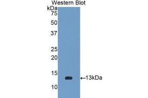 Western Blotting (WB) image for anti-beta-2-Microglobulin (B2M) (AA 22-119) antibody (ABIN1077854) (beta-2 Microglobulin antibody  (AA 22-119))