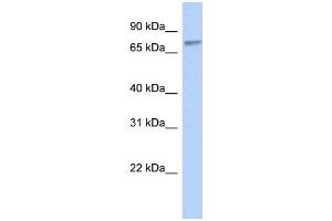 WB Suggested Anti-ZNF45 Antibody Titration:  0. (ZNF45 antibody  (Middle Region))