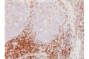 Formalin-fixed, paraffin-embedded human Tonsil stained with CD5 Mouse Monoclonal Antibody (CD5/54/F6). (CD5 antibody)