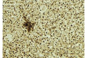 Immunohistochemistry (IHC) image for anti-Nuclear Receptor Subfamily 1, Group D, Member 1 (NR1D1) (N-Term) antibody (ABIN6263713)