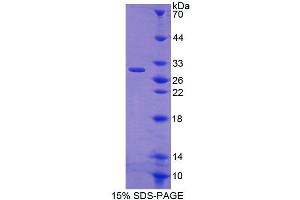 SDS-PAGE analysis of Rat CRISP1 Protein. (CRISP1 Protein)