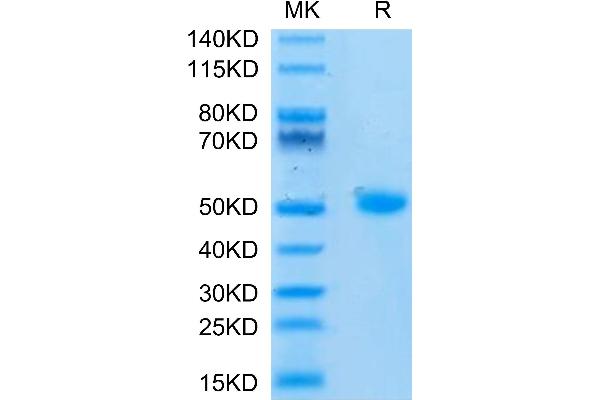 DC-SIGN/CD209 Protein (AA 59-404) (His tag)