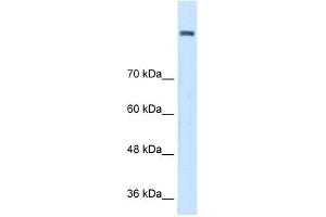 WB Suggested Anti-AOC2 Antibody Titration:  0. (AOC2 antibody  (Middle Region))
