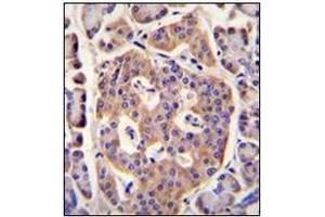 Immunohistochemistry analysis in formalin fixed and paraffin embedded human pancreas tissue reacted with PLD5 Antibody (C-term) followed which was  peroxidase conjugated to the secondary antibody and followed by DAB staining. (PLD5 antibody  (C-Term))