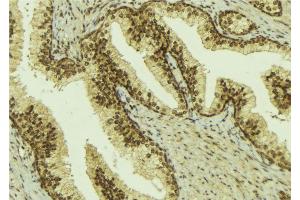 ABIN6274592 at 1/100 staining Mouse colon tissue by IHC-P. (BCOR antibody  (Internal Region))