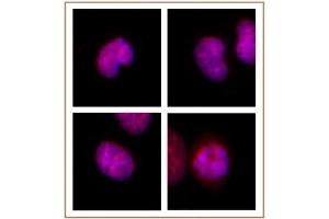 BMI-1 antibody (mAb) tested by Immunofluorescence. (BMI1 antibody)