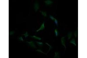 Image no. 3 for anti-Carbonic Anhydrase 12 (CA12) antibody (ABIN1497065) (CA12 antibody)