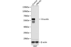 Western blot analysis of extracts from normal (control) and Vimentin knockout (KO) 293T cells using Vimentin Polyclonal Antibody at dilution of 1:1000. (Vimentin antibody)