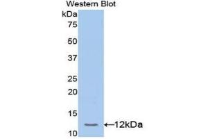 Western Blotting (WB) image for anti-Transcription Factor 20 (TCF20) (AA 125-213) antibody (ABIN1172584)