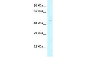 Image no. 1 for anti-Chitinase 3-Like 2 (CHI3L2) (AA 140-189) antibody (ABIN6747890) (CHI3L2 antibody  (AA 140-189))