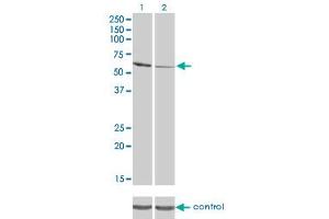 Western blot analysis of RIOK3 over-expressed 293 cell line, cotransfected with RIOK3 Validated Chimera RNAi (Lane 2) or non-transfected control (Lane 1). (RIOK3 antibody  (AA 411-516))