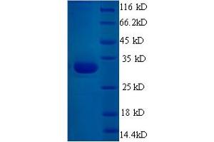 SDS-PAGE (SDS) image for Endothelin Receptor Type A (EDNRA) (AA 39-280) protein (His tag) (ABIN5711018) (Endothelin-1 Receptor Protein (AA 39-280) (His tag))