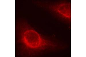 Immunofluorescence staining of methanol-fixed Hela cells, using phospho-CFL1-S3 antibody. (Cofilin antibody  (pSer3))