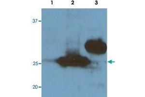 Western blot analysis probed against HEK293 cells transfected with RFP-tagged protein vector; untransfected control (1), transfected with Turbo-RFP (2), and transfected with DeRed (3). (RFP antibody  (N-Term))