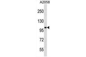 CCDC46 Antibody (N-term) western blot analysis in A2058 cell line lysates (35µg/lane).