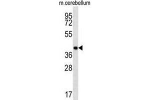 Western Blotting (WB) image for anti-Homeobox D13 (HOXD13) antibody (ABIN2998512) (Homeobox D13 antibody)