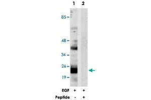 Western blot analysis of extracts from NIH/3T3 cells, treated with EGF (200 ng/mL, 30 mins), using PTGES3 polyclonal antibody . (PTGES3 antibody  (Ser113))