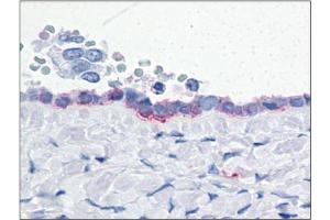 Human Ovary: Formalin-Fixed, Paraffin-Embedded (FFPE) (ENPP3 antibody  (Internal Region))