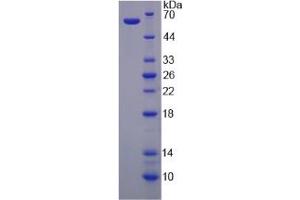 Image no. 1 for Voltage-Dependent Anion Channel 1 (VDAC1) (AA 2-283) protein (His tag,GST tag) (ABIN4990624) (VDAC1 Protein (AA 2-283) (His tag,GST tag))