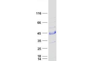 Validation with Western Blot (SNX21 Protein (Transcript Variant 2) (Myc-DYKDDDDK Tag))
