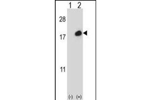 Western blot analysis of ISG15 (arrow) using rabbit polyclonal ISG15 Antibody (C-term ) (ABIN387984 and ABIN2844985).