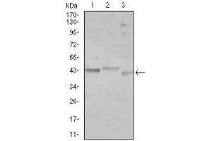 Western blot analysis using CEBPA mouse mAb against Jurkat (1), k562 (2), and HepG2 (3) cell lysate. (CEBPA antibody)
