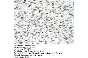 Rabbit Anti-HNRPAB Antibody  Paraffin Embedded Tissue: Human Heart Cellular Data: Myocardial cells Antibody Concentration: 4. (HNRNPAB antibody  (C-Term))