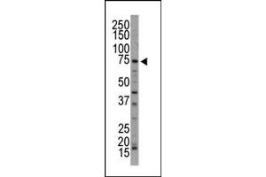Western Blotting (WB) image for anti-NUAK Family, SNF1-Like Kinase, 1 (NUAK1) (C-Term) antibody (ABIN360528)