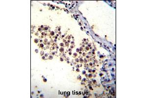 DOK3 Antibody (C-term) (ABIN655979 and ABIN2845363) immunohistochemistry analysis in formalin fixed and paraffin embedded human lung tissue followed by peroxidase conjugation of the secondary antibody and DAB staining. (DOK3 antibody  (C-Term))