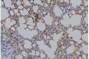 Immunohistochemistry (IHC) image for anti-alpha-Methylacyl-CoA Racemase (AMACR) (Internal Region) antibody (ABIN6259906)
