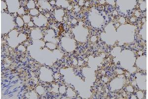 ABIN6276534 at 1/100 staining Mouse lung tissue by IHC-P. (AMACR antibody  (Internal Region))
