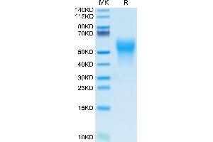 Biotinylated Human IL-18BP on Tris-Bis PAGE under reduced condition. (IL18BP Protein (AA 31-194) (His-Avi Tag,Biotin))