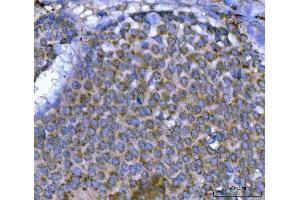 IHC analysis of MSF/SEPTIN9 using anti-MSF/SEPTIN9 antibody (ABIN7600104). (Septin 9 antibody  (AA 15-282))