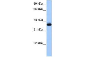 ERI2 antibody used at 1 ug/ml to detect target protein. (ERI2 antibody  (Middle Region))