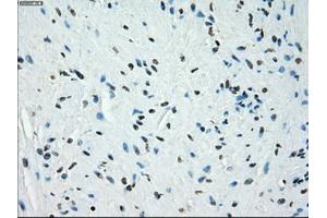 Immunohistochemical staining of paraffin-embedded endometrium tissue using anti-KDM4C mouse monoclonal antibody. (KDM4C antibody)