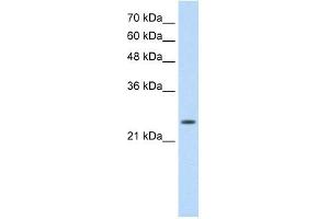 Troponin I Type 1 antibody used at 0. (TNNI1 antibody)