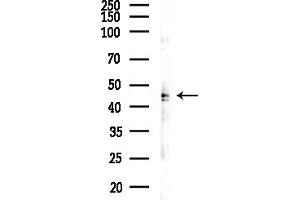 anti-Branched Chain Ketoacid Dehydrogenase Kinase (BCKDK) (N-Term) antibody